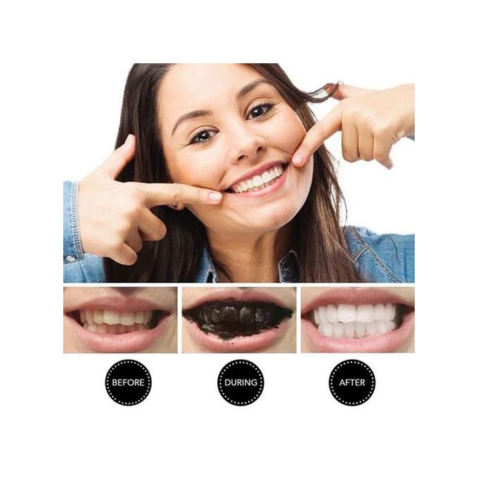 Miracle Teeth Blanchiment dentaire NATUREL